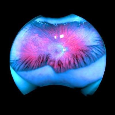 BBBBB - Simple Delights (2021)