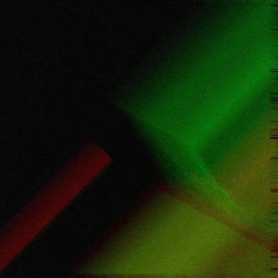 Bily - Anxiety (2021)