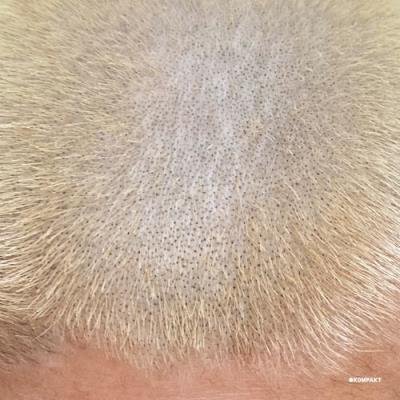 Barnt - ProMetal Fan Decor Only Product (2022)